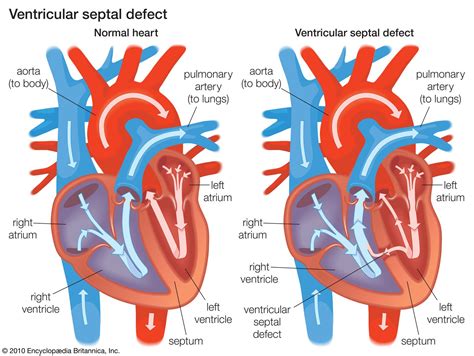 Physiology, Left Ventricular Function .